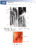 Sobotta  Atlas of Human Anatomy  Trunk, Viscera,Lower Limb Volume2 2006, page 115